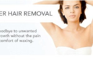 laser hair removal in New York