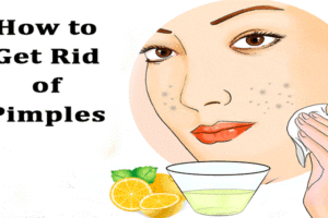 How to get rid of pimples