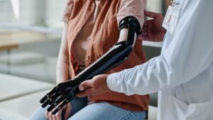 Prosthetic Arms
