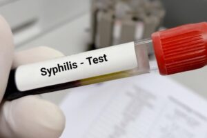 Rapid Syphilis Test