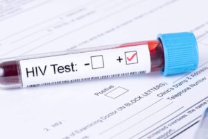 Follow-Up Testing After PEP for HIV Prevention