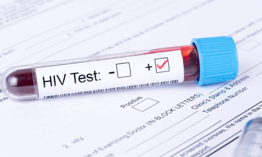 Follow-Up Testing After PEP for HIV Prevention