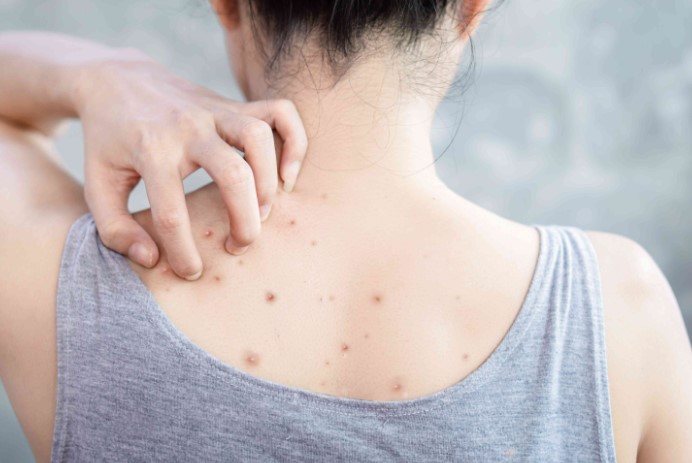 Bacne Treatment Singapore