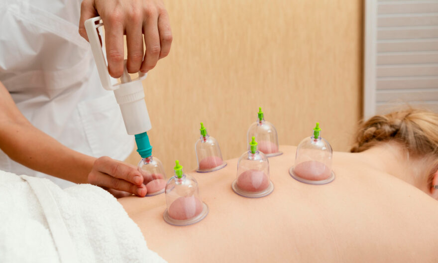 Cupping Therapy For Health Improvement