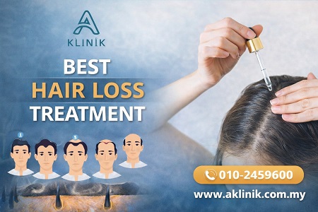 best hair loss treatment