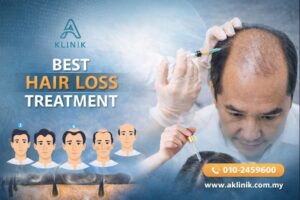 best hair loss treatment