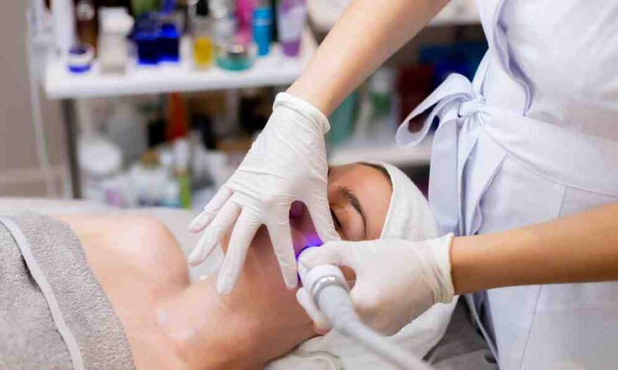 radio frequency treatment