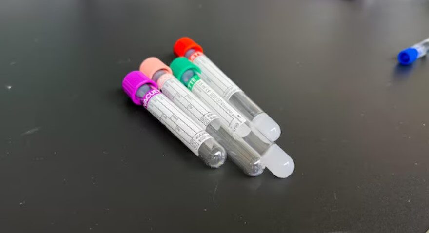 Genetic Testing Kits